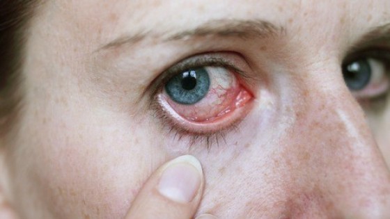 Ung thư mắt – Căn bệnh hiếm gặp nhưng cực kì nguy hiểm mà ai cũng cần biết