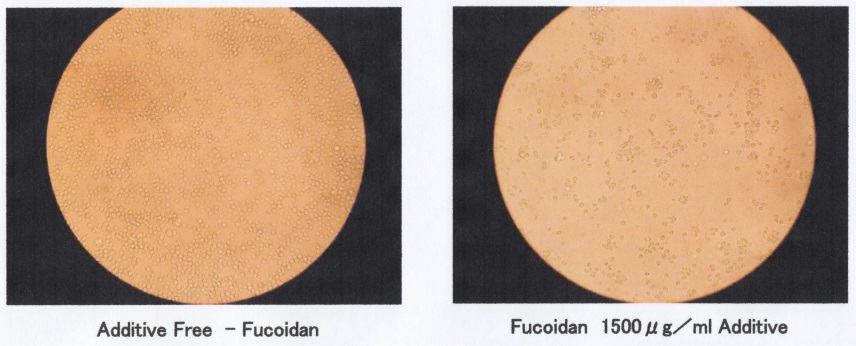 Fucoidan ức chế tế bào khối u